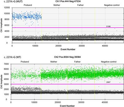 Paternal De Novo Variant of TAOK1 in a Fetus With Structural Brain Abnormalities